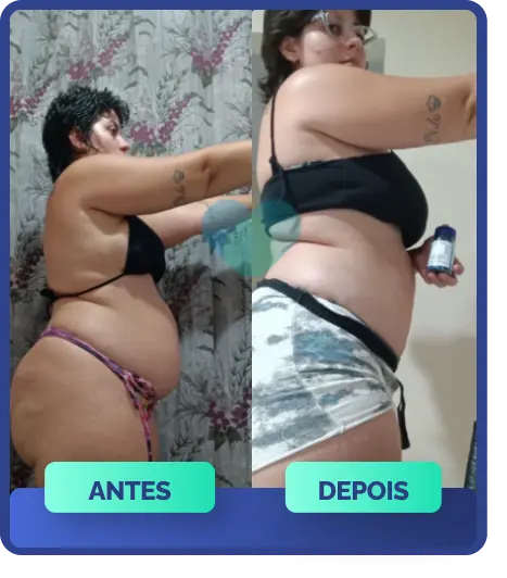 Resultados com OzenVitta - imagem de antes e depois de emagrecimento com suplemento natural